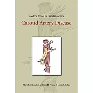 Carotid Artery Disease