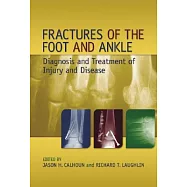 Fractures of the Foot and Ankle: Diagnosis and Treatment of Injury and Disease