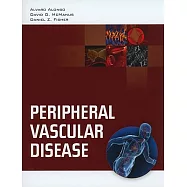 Peripheral Vascular Disease