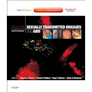 Atlas of Sexually Transmitted Diseases and AIDS