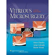 Vitreous Microsurgery