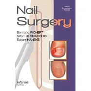 Nail Surgery