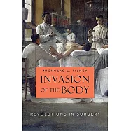 Invasion of the Body: Revolutions in Surgery