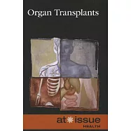 Organ Transplants