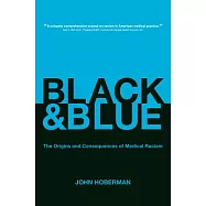 Black and Blue: The Origins and Consequences of Medical Racism