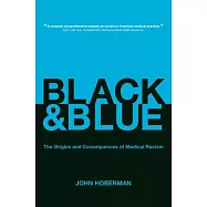 Black and Blue: The Origins and Consequences of Medical Racism