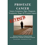 Prostate Cancer: Causes, Symptoms, Signs, Diagnosis, Treatments, Stages, What You Need to Know About Prostate Cancer