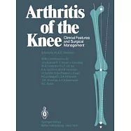 Arthritis of the Knee: Clinical Features and Surgical Management