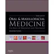 Oral and Maxillofacial Medicine: The Basis of Diagnosis and Treatment