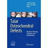 Talar Osteochondral Defects