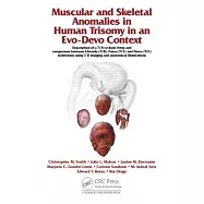 Muscular and Skeletal Anomalies in Human Trisomy in an Evo-Devo Context: Description of a T18 Cyclopic Fetus and