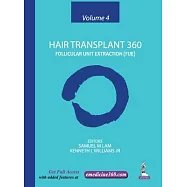 Hair Transplant 360: Volume 4: Follicular Unit Extraction