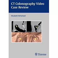 CT Colonography Video Case Review