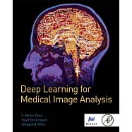 Deep Learning for Medical Image Analysis