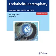 Endothelial Keratoplasty: Mastering DSEK, DMEK, and PDEK