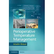 Perioperative Temperature Management