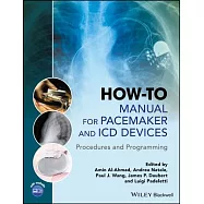 How-to Manual for Pacemaker and ICD Devices: Procedures and Programming