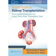 Quick Guide to Kidney Transplantation: From Initial Evaluation to Long-term Posttransplantation Care