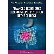 Advanced Techniques for Endoscopic Resection in the GI Tract
