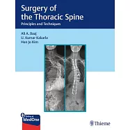 Surgery of the Thoracic Spine: Principles and Techniques