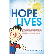 Hope Lives: Little Life. Big Purpose. Seeing a New View from a Child with Special Needs.
