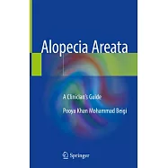 Alopecia Areata: A Clinician’s Guide