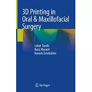 3d-Printing in Oral & Maxillofacial Surgery