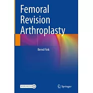 Femoral Revision Arthroplasty