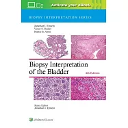 Biopsy Interpretation of the Bladder