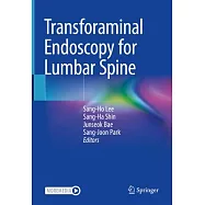 Transforaminal Endoscopy for Lumbar Spine