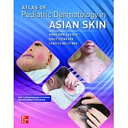 Atlas of Pediatric Dermatology in Asian Skin