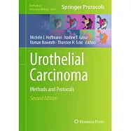 Urothelial Carcinoma: Methods and Protocols