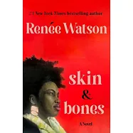 Skin & Bones