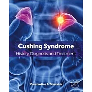 Cushing Syndrome: History, Diagnosis and Treatment