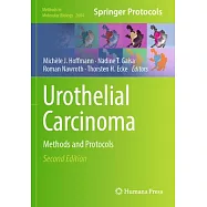 Urothelial Carcinoma: Methods and Protocols