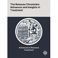 The Rosacea Chronicles: Advances and Insights in Treatment