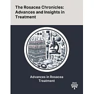 The Rosacea Chronicles: Advances and Insights in Treatment