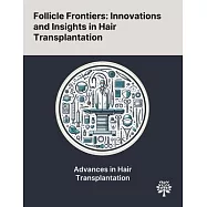 Follicle Frontiers: Innovations and Insights in Hair Transplantation