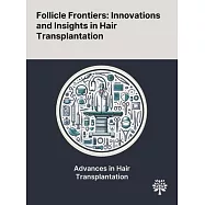 Follicle Frontiers: Innovations and Insights in Hair Transplantation