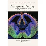 Developmental Oncology: Principles and Therapy of Cancers of Children and Young Adults