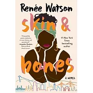 Skin & Bones