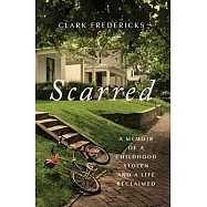Scarred: A Memoir of a Childhood Stolen and a Life Reclaimed