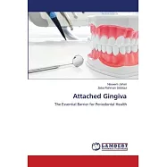 Attached Gingiva