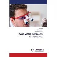 Zygomatic Implants