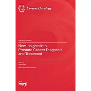 New Insights into Prostate Cancer Diagnosis and Treatment