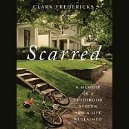 Scarred: A Memoir of a Childhood Stolen and a Life Reclaimed