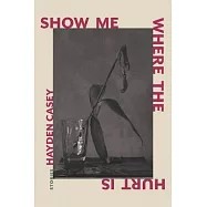 Show Me Where the Hurt Is: Stories