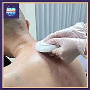 (電子票) 新竹【林療工作室】[職業病剋星]職人刮痧(上半身+加時30分鐘)首次體驗(Mo)【受託代銷】