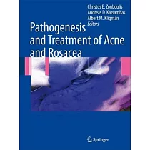Pathogenesis and Treatment of Acne and Rosacea