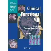 Clinical Functional MRI： Presurgical Punctional Neuroimaging